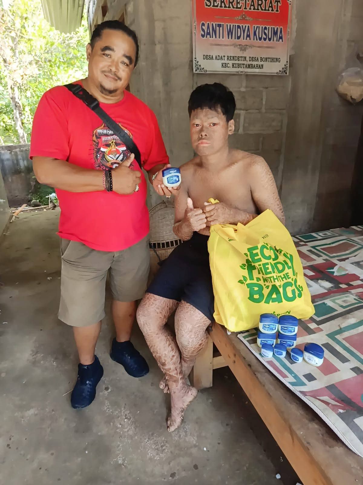 Charitable Foundation Aid Bali