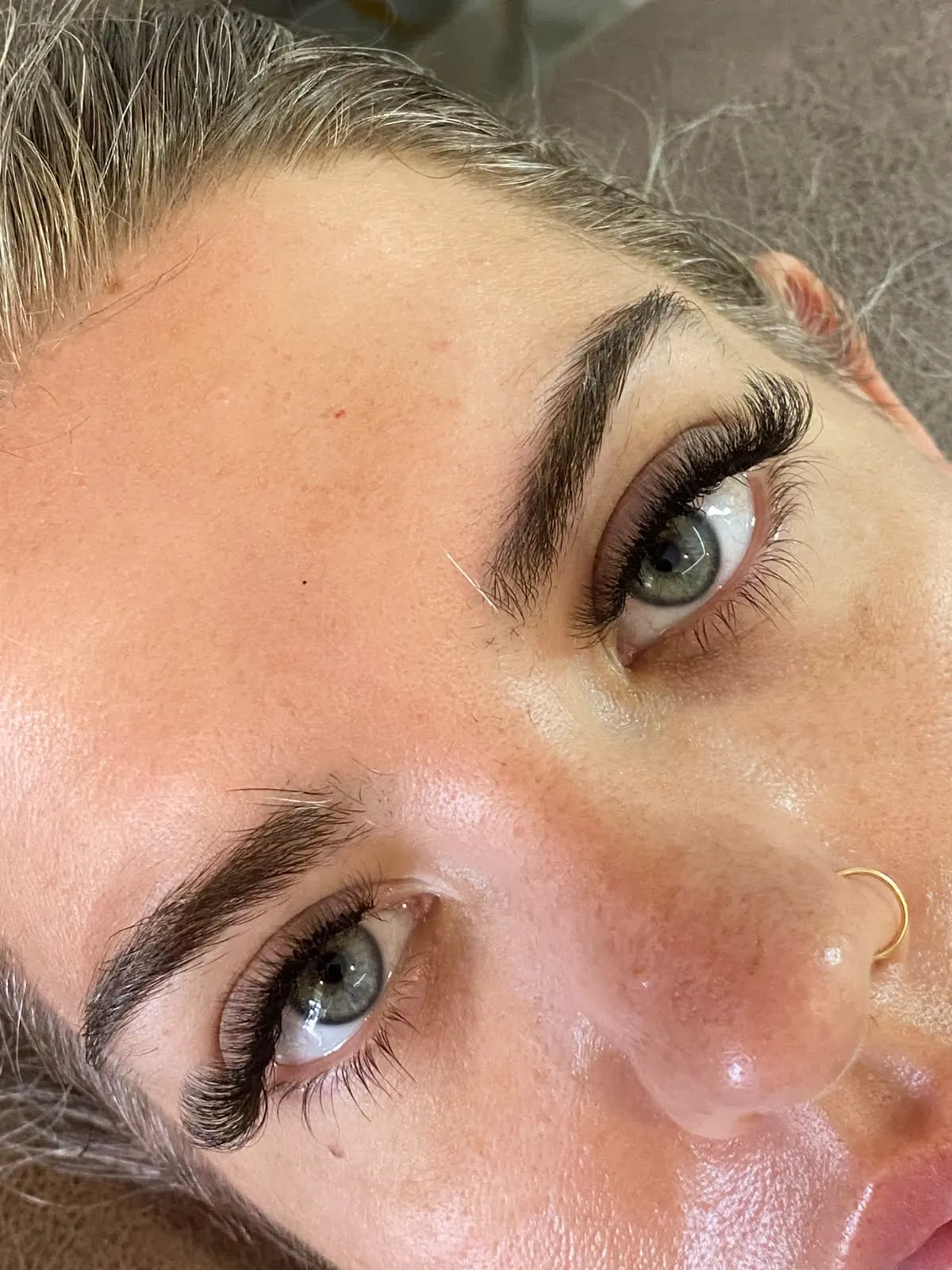 Eye treatment close-up